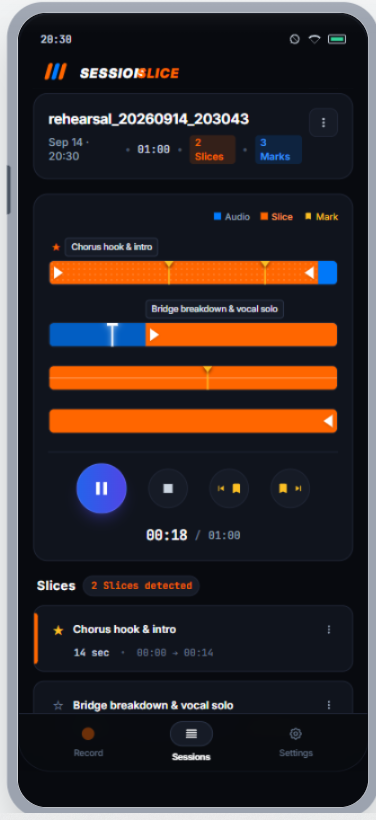 SessionSlice timeline showing Slices and Marks inside a recording